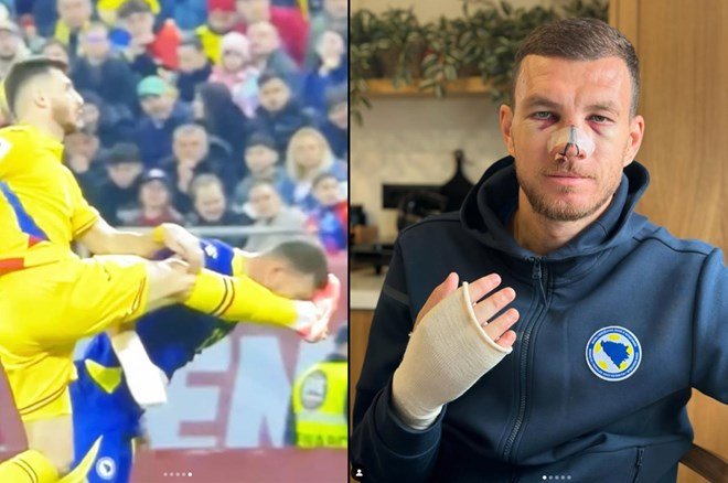 afb957e762454f1085322694f1100a62-1 Fenerbahçe'de milli futbolcuların karnesi: 13 isim arasında Livakovic damgası - 5. Foto